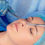 Récupération de rhinoplastie : combien de temps ?